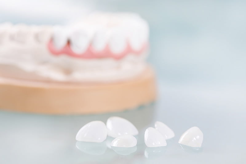 Individuelle Beratung bei Ihrer Zahnarztpraxis Nadjar