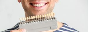 Bleaching Wie kann man Zähne problemlos bleichen