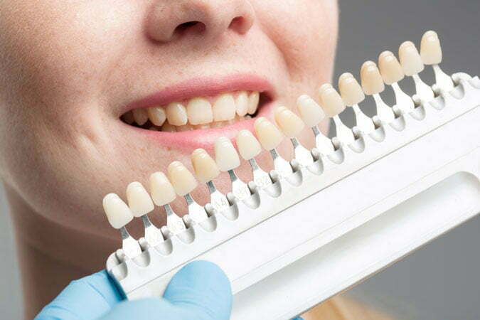 Bleaching Fürth